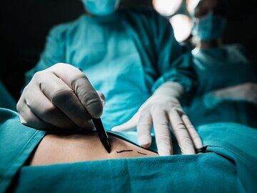 خارج کردن توده ۵ کیلویی از شکم یک زن در اسدآباد+عکس