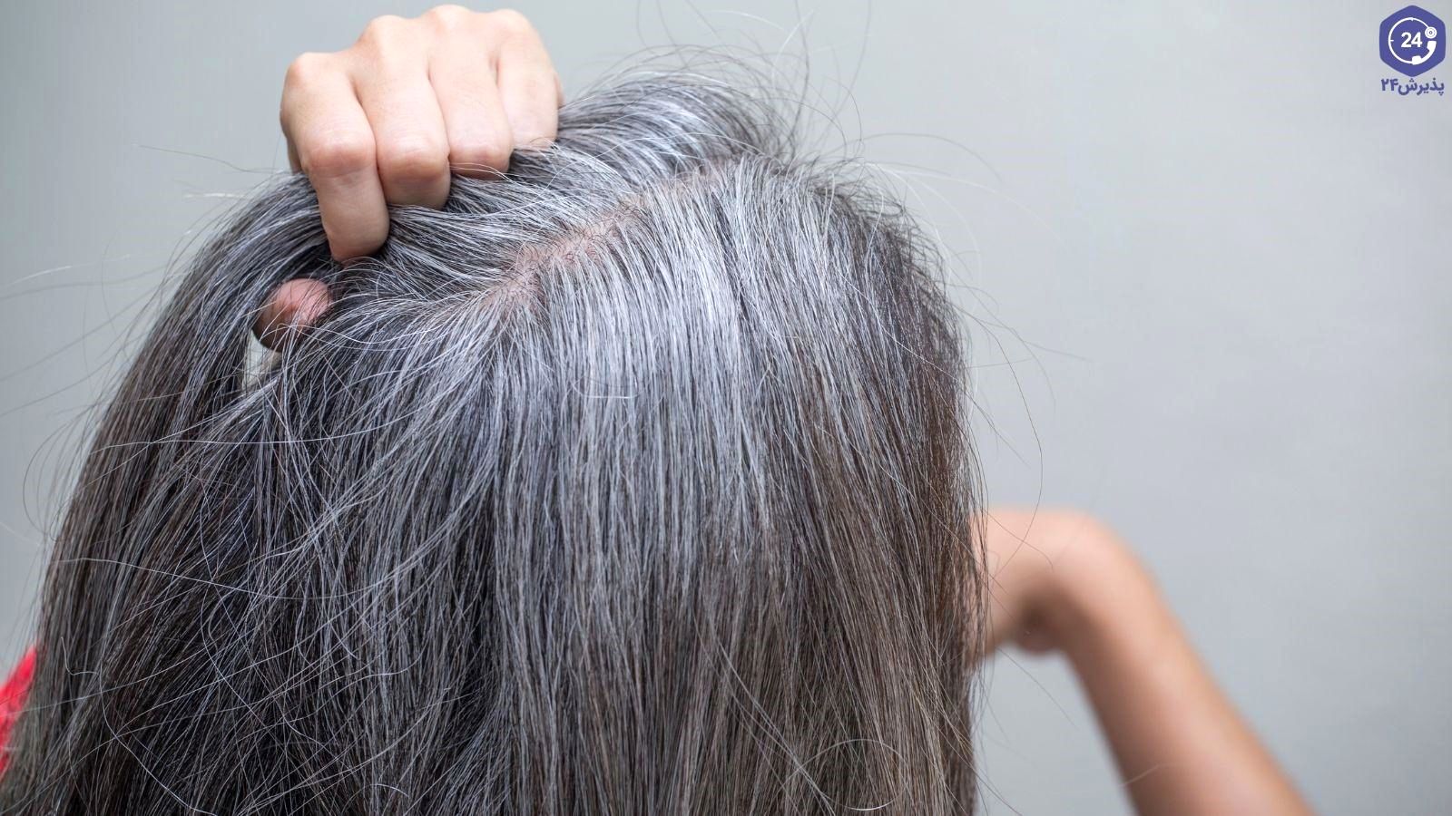 چند اقدام ساده و کاربردی برای جلوگیری و رفع سفیدی مو 