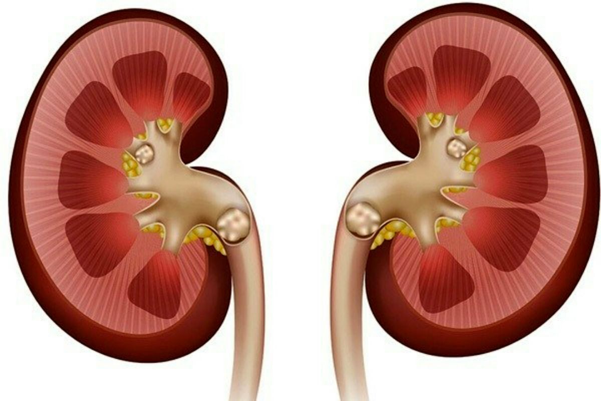 میوه های مفید و مضر برای کلیه کدامند؟