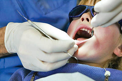روش های مختلف سفید کردن دندان