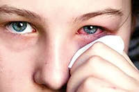 علل و علائم  عفونت چشم چیست؟