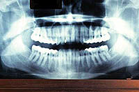 سومین کنگره بین‌المللی جراحی دهان، فک و صورت برگزار می‌شود
