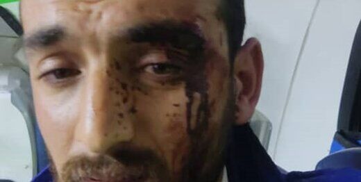 حمله خونین به پرسنل اورژانس تهران با قمه!+ عکس