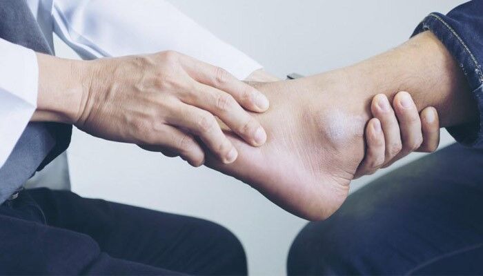 انواع آسیب دیدگی‌های مچ پا
