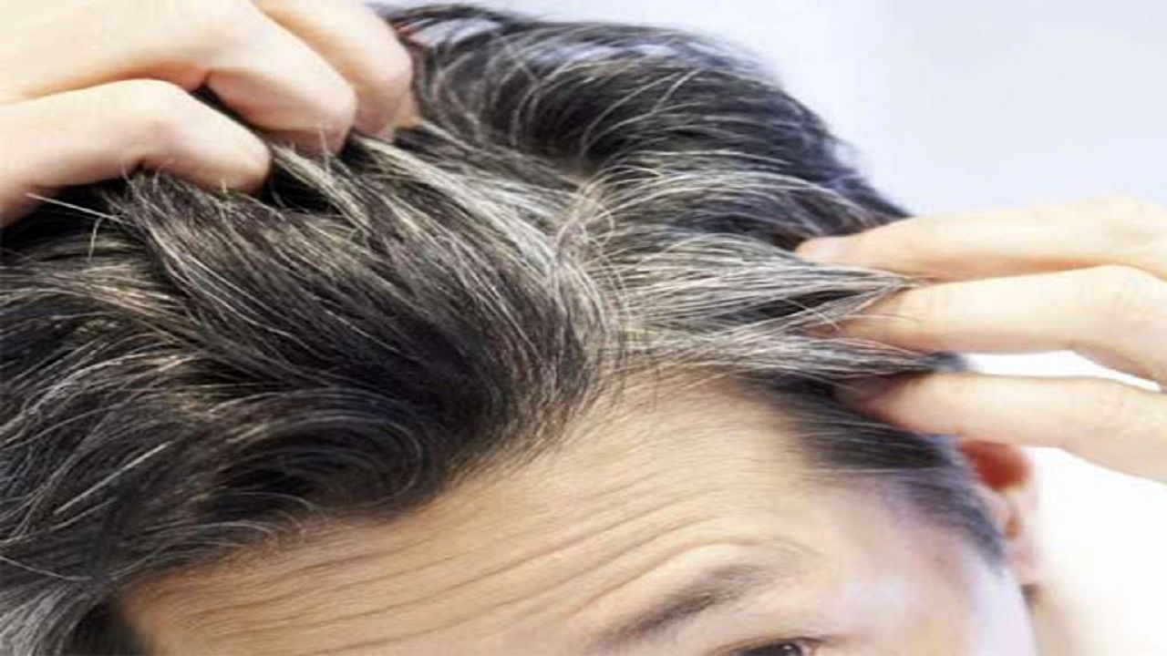 علت سفیدى مو در سنین جوانى چیست؟