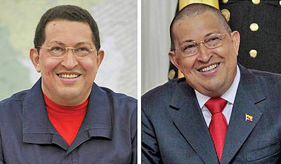 چاوز با چهره‌ای جدید: شیمی‌درمانی تاثیر بیشتری بر چهره‌ام می‌گذارد