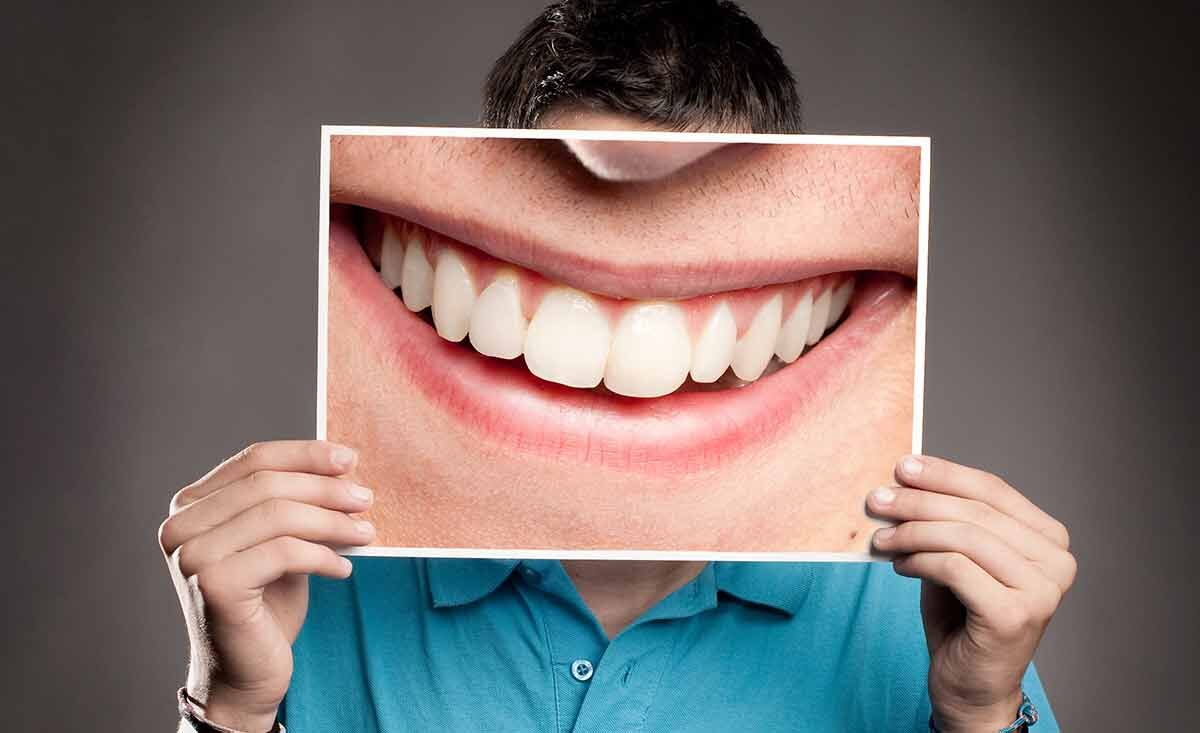 زیبایی لبخند چقدر هزینه دارد؟