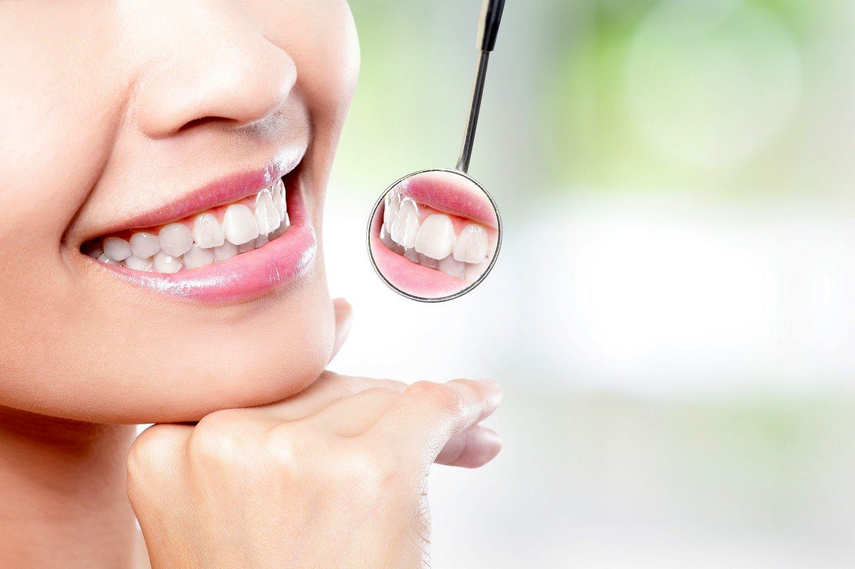 اقتصادی ‌ترین راه برای بهبود ظاهر دندان ها