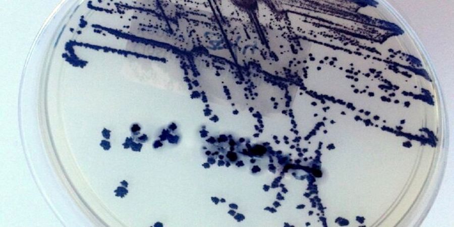 کسب ماهیانه 1200 دلار تنها با اهدای مدفوع