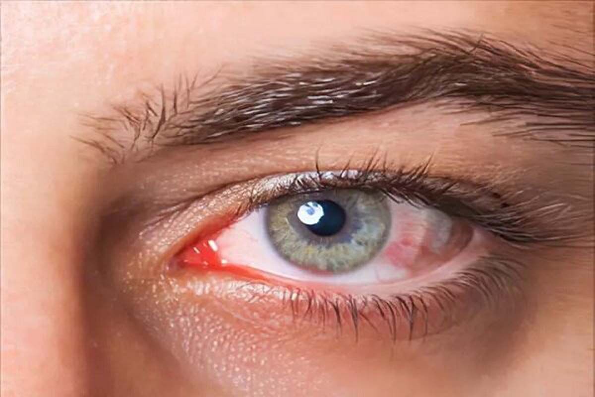  باورهای اشتباه در خصوص شست و شو با چای 