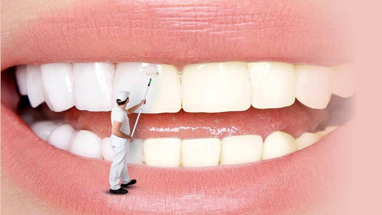 روش هایی کم هزینه برای سفید کردن دندان هایتان