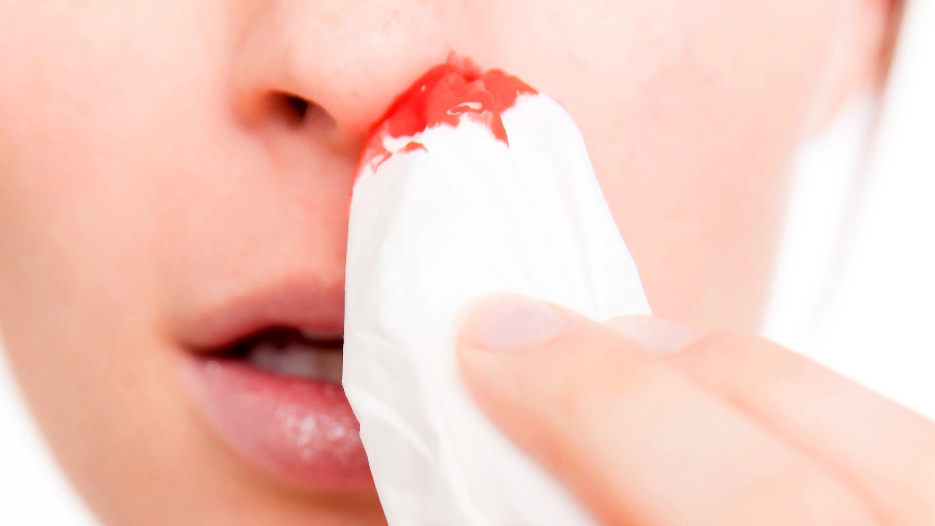 6 راهکار موثر برای توقف خونریزی بینی