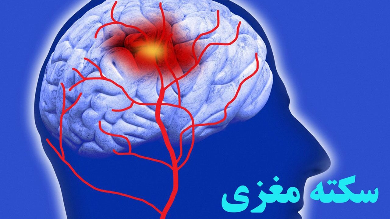 اینها نشانه سکته مغزی هستند!