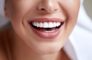 کمبود کدام ویتامین باعث پوسیدگی دندان می‌شود؟