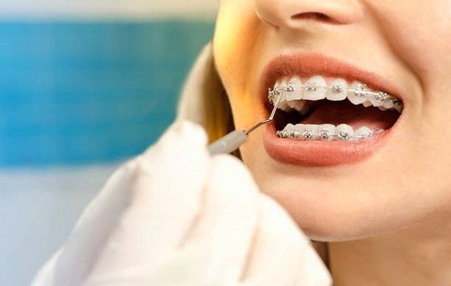آشنایی با دندانپزشک در تهران