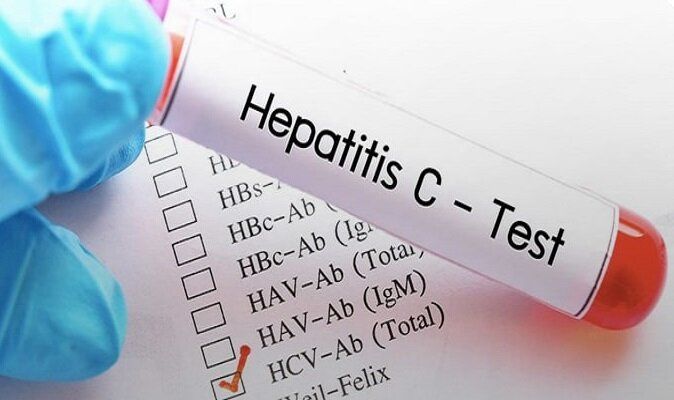 برنامه وزارت بهداشت برای حذف هپاتیت C در کشور + جزئیات