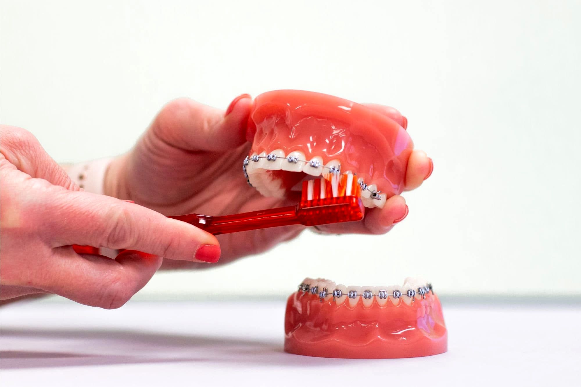 چگونه از ارتودنسی دندان خود بهتر مراقبت کنید؟