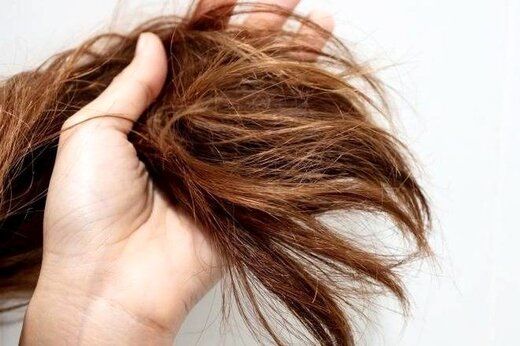 10 روش درمانی برای از بین بردن موهای چرب