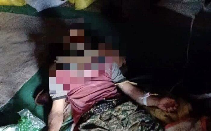 عکسی از حمله خرس به نوجوان 16 ساله 2
