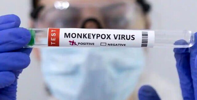 شناسایی دو بیمار مشکوک به آبله میمونی در افغانستان