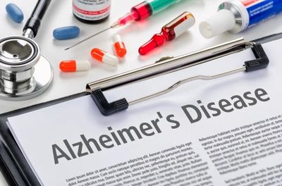 کشف روشی جدید برای پیشگیری از آلزایمر