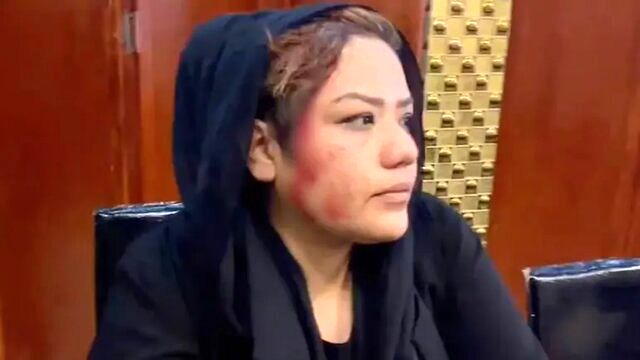 حمله وحشیانه طالبان به اعتراضات زنان در کابل