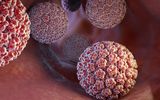 6 اشتباه رایج درباره واکسن HPV / این خطرات را جدی بگیرید