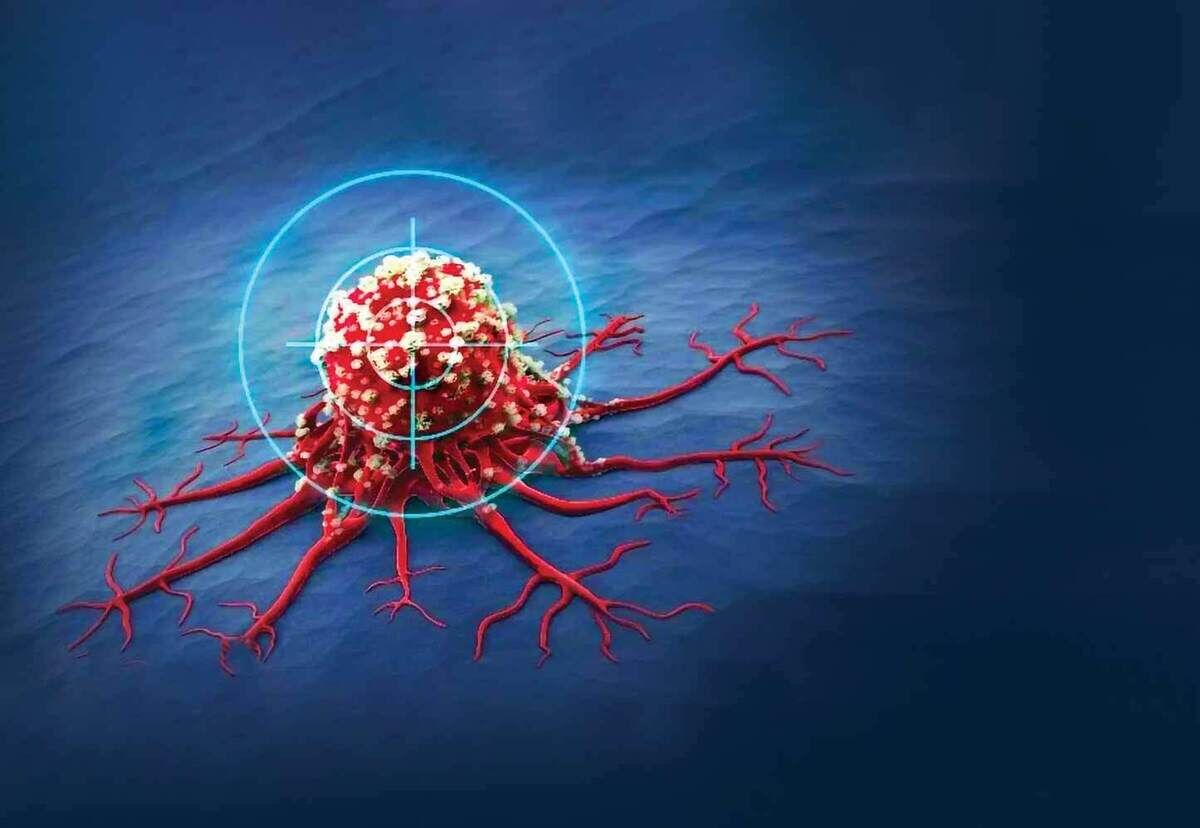 ثبت هر ساعت 2 مورد جدید از سرطان پستان در ایران/ زنان این توصیه‌ها را جدی بگیرند