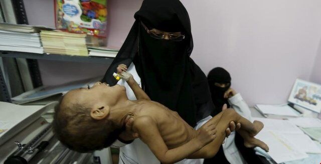 هشدار جدی سازمان ملل در مورد قحطی در ۲۰ کشور جهان