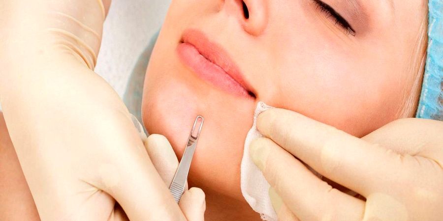 این جوش های خطرناک را دستکاری نکنید