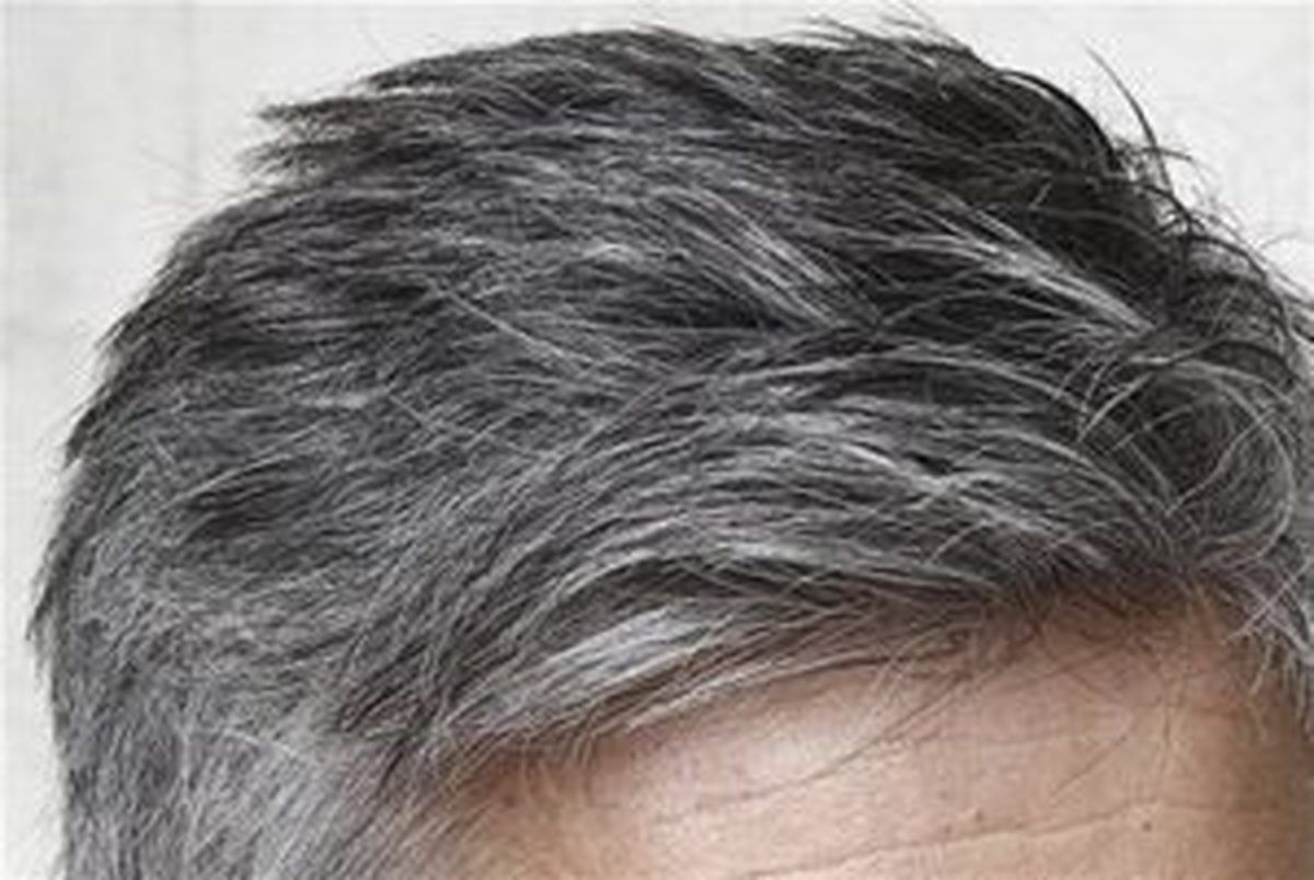 استرس باعث سفیدی مو می‌شود؟
