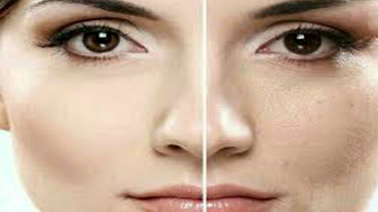 با این ۷ روش پوستتان را صاف و زیبا کنید