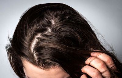 بیماری خطرناک در کمین کسانی که موهایشان را کراتین می کنند