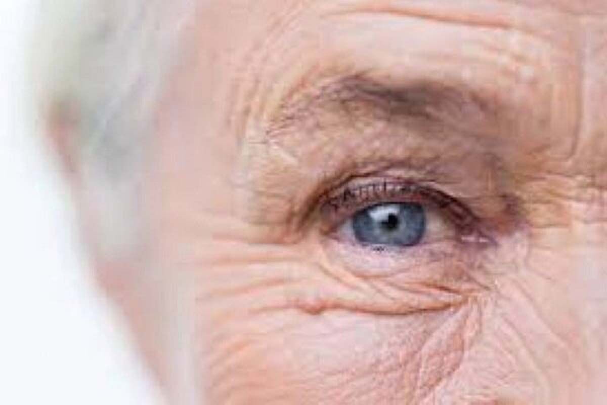  ۹ علت شایع پیری زودرس پوست +راهکار مقابله 