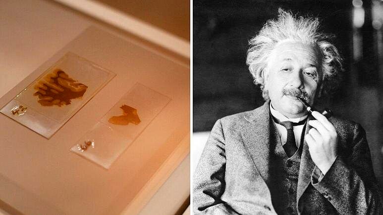 ماجرای دزدی مغز اینشتین توسط یک پزشک+عکس