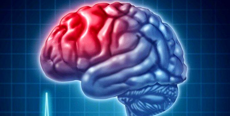مهم‌ترین علائم سکته مغزی چیست؟
